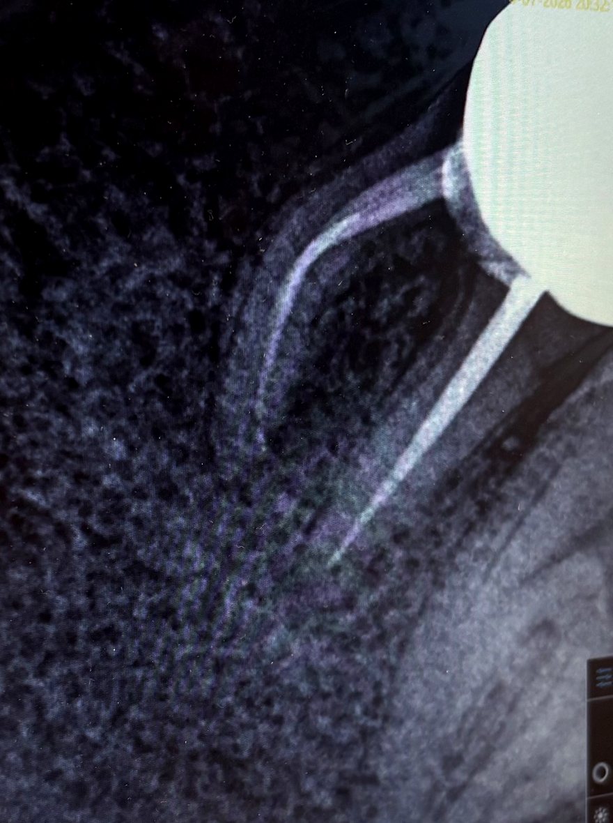 Root canal radiograph attached by the patient to their Google review